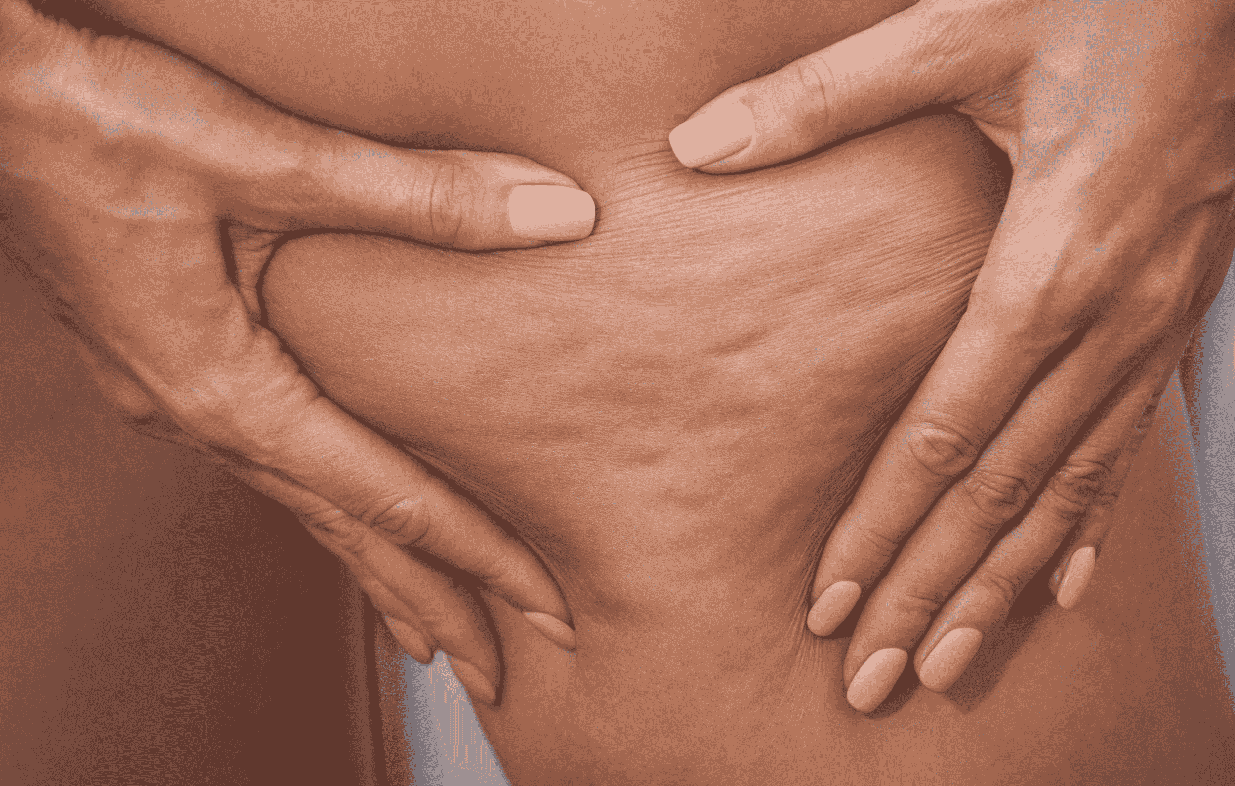 3 Strategien, um Cellulite zu reduzieren kollagen collamin